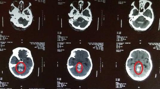 脑在线观看,探索大脑奥秘的数字之旅  第2张 脑在线观看,探索大脑奥秘的数字之旅  第2张